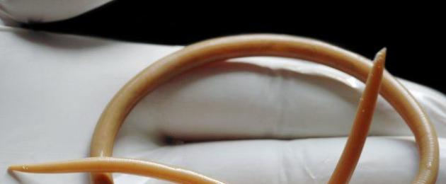 Что такое тип круглые черви. Тип Круглые черви (Nemathelminthes) Общая характеристика типа