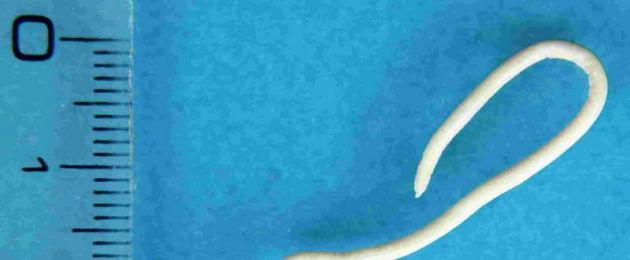 Полезные черви в организме человека. Паразиты живущие в организме человека, фото – скрытые заболевания с серьезными последствиями