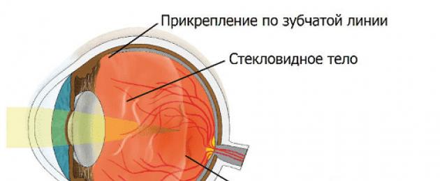 Il corpo vitreo dell'occhio presenta opacità fluttuanti.  Opacità fluttuanti nel vitreo