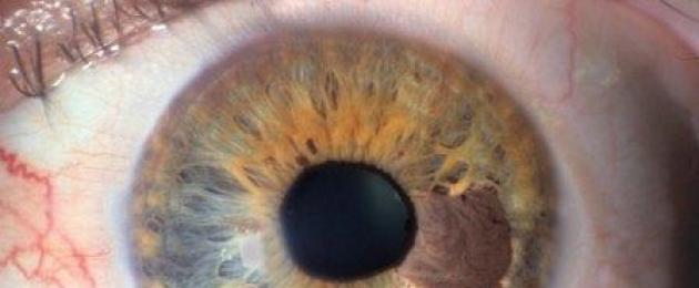 Ультразвуковая диагностика глаза: как проходит процедура, какое оборудование применяется. Ультразвуковое А и Б сканирование (эхобиометрия): как проводится и в чем разница между ними Что показывают результаты