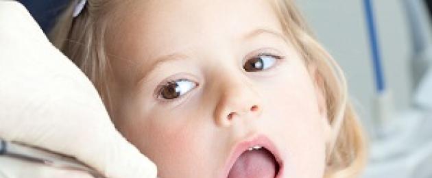 Malattia parodontale nei bambini, trattamento delle malattie croniche infantili.  Cosa sai fare