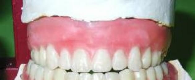Как держатся зубы в челюсти. Особенности строения зубов