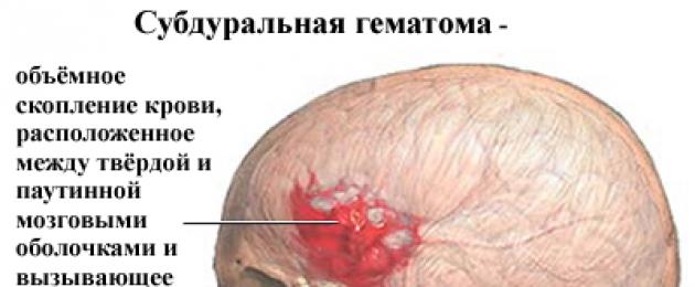 Trapanazione del cranio fasi dell'operazione.  Craniotomia: quando necessaria, condotta, riabilitazione