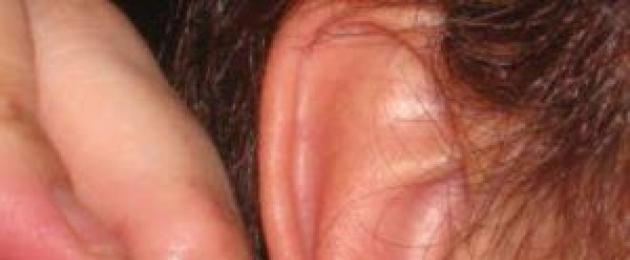 У грудничка болят уши от ушного грибка. Грибок в ушах: как лечить? Почему появляется? Симптомы и фото