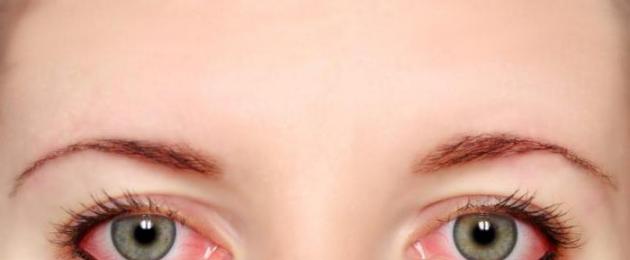 Infiammazione dell'occhio: tipi, sintomi, trattamento.  Trattamento delle malattie degli occhi con rimedi popolari