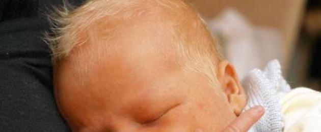 Причины, симптомы, лечение и последствия желтухи у новорожденных. Желтуха новорожденных