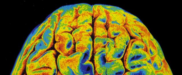 التصوير بالرنين المغناطيسي للدماغ المتوسط.  تشريح الدماغ في صورة التصوير بالرنين المغناطيسي