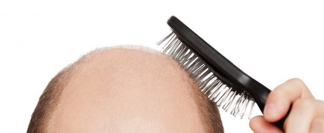 Симптомы и лечение герпеса на голове в волосах при впг и опоясывающем лишае. Почему возникает и чем опасен герпес на голове