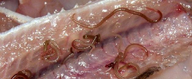 Quali sono i sintomi della malattia da vermi?  Elminti nel trattamento dei sintomi dell'uomo