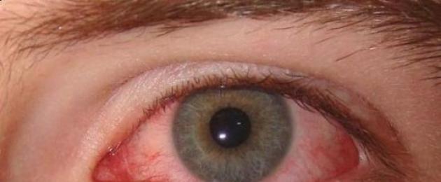 Осложнения после операции на глаза катаракта. Осложнения после замены хрусталика глаза при катаракте
