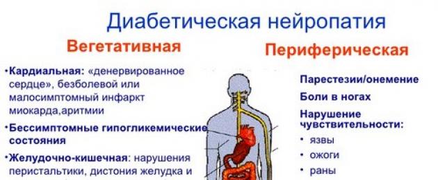 Лечение периферической нейропатии программа государственных гарантий. Периферическая нейропатия — эффективное лечение возможно при соблюдении этих правил и советов