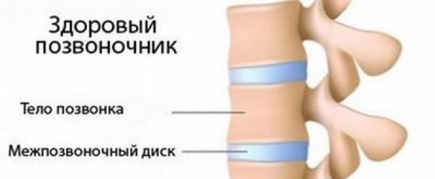 Когда наклоняешь голову хруст слышен. Как избавиться от хруста в шее