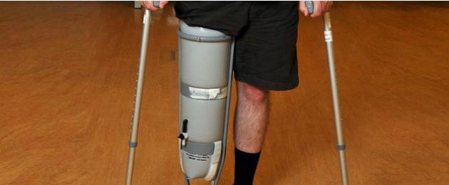 Протезы ног: малоизвестные факты. Можно ли пользоваться протезом сразу после ампутации? Нужно ли носить протез ноги