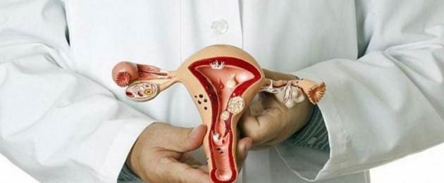 Raschiamento diagnostico separato dell'utero.  Isteroscopia e curettage diagnostico separato
