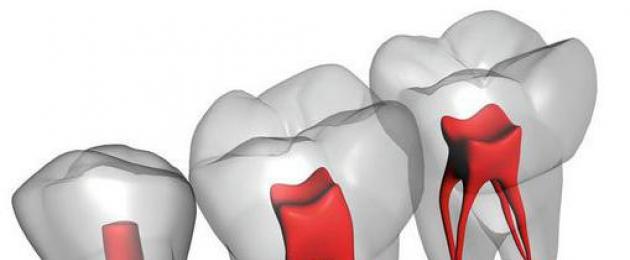 Radici dei denti molto lunghe.  La struttura della mascella e dei denti nell'uomo: canini, molari e incisivi