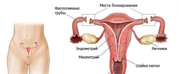 Rimozione della vena dorsale (dorsale profonda) del pene.  Legatura delle tube: l'essenza della procedura, indicazioni, condotta, risultato Legatura dell'esame degli organi genitali