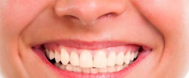 Отбеливание зубов у стоматолога виды. Отбеливание зубов без стоматолога: риски