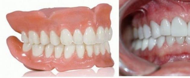 التحقق من تصميم طقم أسنان كامل قابل للإزالة.  العضة الصحيحة عند البشر: الأصناف والصور