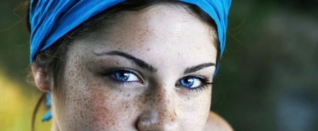 Pigmento della pelle.  Pigmentazione della pelle del viso.  Cause della pigmentazione della pelle.  Tipi di pigmentazione