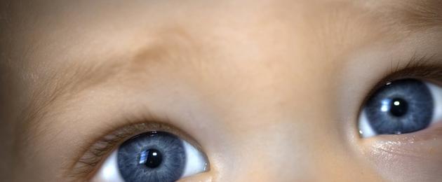 Il bambino ha lividi sotto gli occhi.  Lividi sotto gli occhi di un bambino: cause (per categorie di età), metodi di trattamento, prevenzione