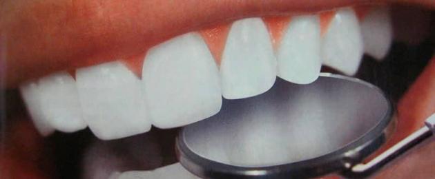  Лечение больного зуба в домашних условиях. 