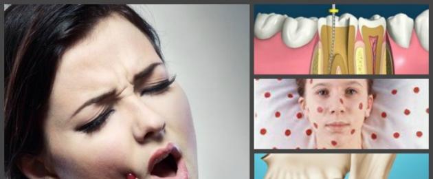 Почему болит зуб под пломбой при надавливании. Болит зуб и десна над зубом при нажатии на него: в чем причина возникающей зубной боли