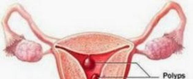 Cambiamenti degenerativi nell'epitelio della cervice.  Tipi di cambiamenti reattivi nello strato epiteliale dell'utero