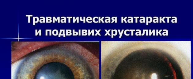 Травматическая катаракта и её лечение. Виды и лечение травматической катаракты Разрыв катаракты