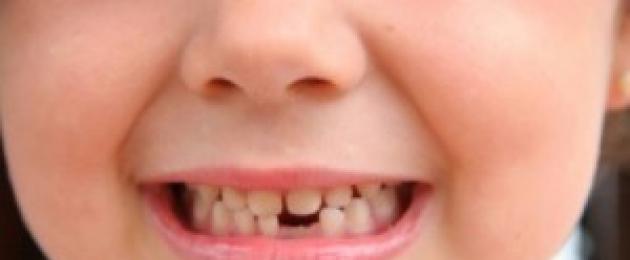 Приметы про зубы у взрослых. Приметы об отколовшемся зубе