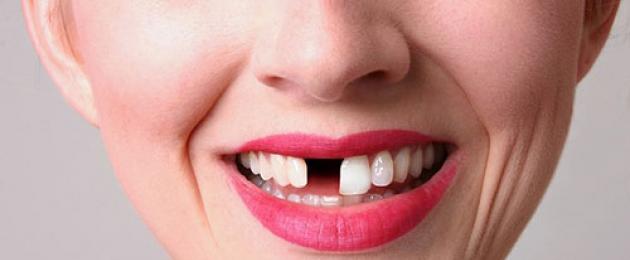 Сон о выпадении зубов. Что значит если снится что выпал зуб, стоит ли опасаться за свое здоровье