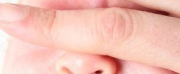 Белый налет на языке у ребенка. Причины белого налета на языке у новорожденного: удаление и профилактика