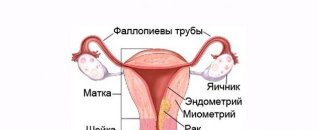 Можно ли определить наличие рака матки на УЗИ? Что показывает УЗИ при миоиме матки, эрозии и раковых опухолях шейки матки? Может ли узи выявить рак матки. 