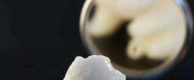 Conseguenze sulla salute dei denti marci.  Rimozione della radice del dente