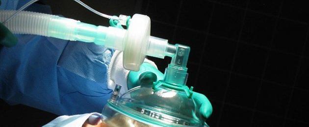 Cosa influisce l'anestesia?  Anestesia generale: conseguenze per il corpo