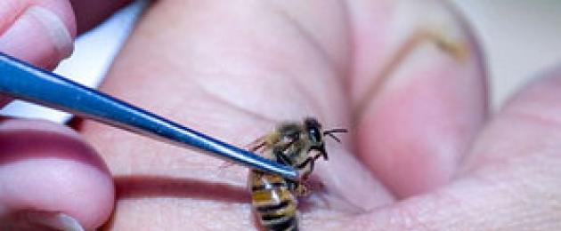 Укусы пчел против простатита, или апитерапия: схемы лечения, точки для ужаливаний и противопоказания. Основные методики пчёлоужалений