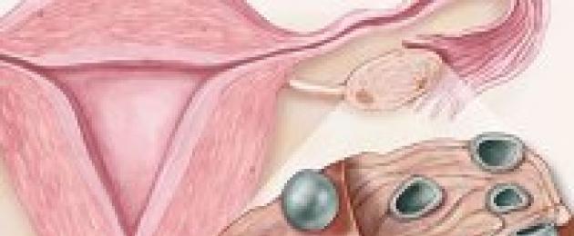 Гормональная контрацепция. Сравнение марвелона и ярины Как перейти с ярины на марвелон