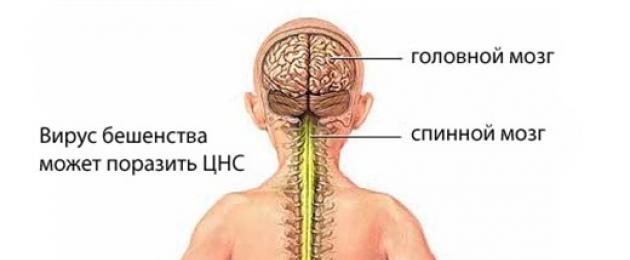 Вирус бешенства клиническая картина