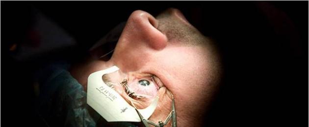 Опасность лазерной коррекции зрения. Возможные последствия лазерной коррекции зрения