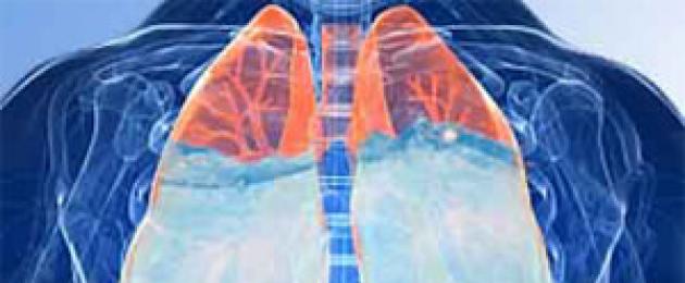 Come si manifesta l'edema polmonare nei pazienti allettati.  Cause e conseguenze dell'edema polmonare: questa conoscenza può salvare una vita