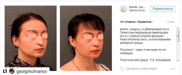 Примеры косметологических аккаунтов в инстаграмме. Основы продвижения клиники в instagram