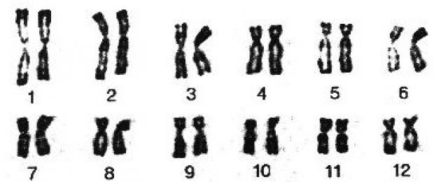 Набор хромосом у человека 46 хромосом. Сколько хромосом у человека? Меняется ли их количество