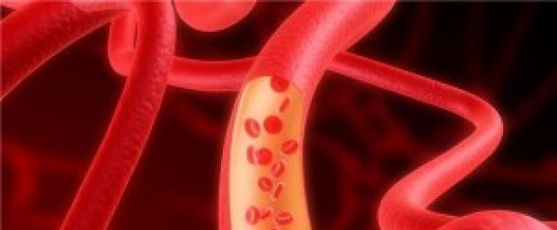 كيفية استعادة عمل الأوعية الدموية في جسم الإنسان.  هل مرونة الأوعية الدموية مهمة؟  الحل الطبي للمشكلة