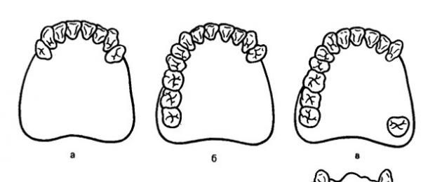 Классификация зубных дефектов. Дефекты зубных рядов