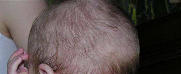 بقعة حمراء زاهية على جلد الأطفال حديثي الولادة.  بقعة حمراء على مؤخرة الرأس: أسباب وعلاج الأمراض