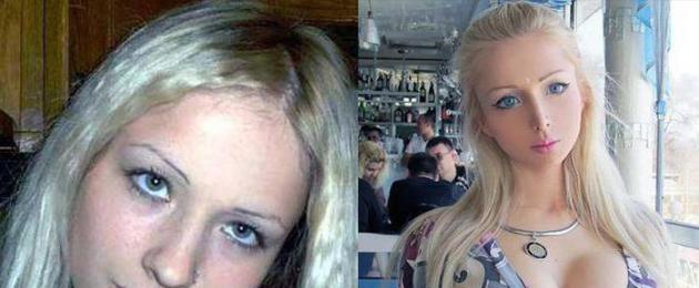 Валерия лукьяненко до операции. Фото валерии лукьяновой до и после операции