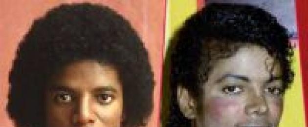 Как майкл джексон отбелил кожу. Как Майкл Джексон поменял цвет кожи? Лечение витилиго Майкла Джексона