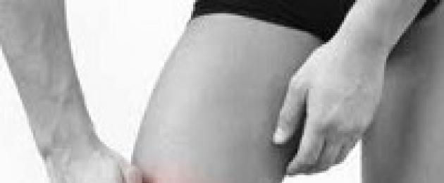 Sintomi e trattamento della tendinite al ginocchio.  Sintomi, stadi e trattamento della tendinite dell'articolazione del ginocchio e del tendine rotuleo