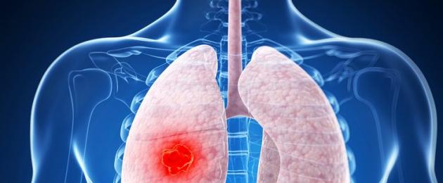 Echinococcosi polmonare: cause, sintomi e trattamento.  Echinococcosi polmonare, sintomi e cause, trattamento della malattia