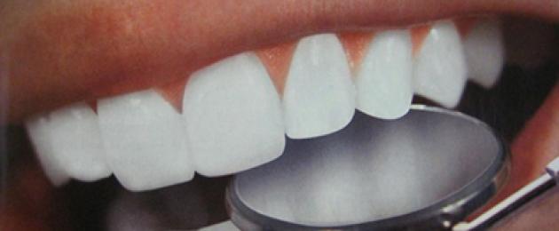 Как можно очистить зубы от желтого налета в домашних условиях. Чистка зубов в домашних условиях самый лучший способ Как очистить зубы в домашних условиях
