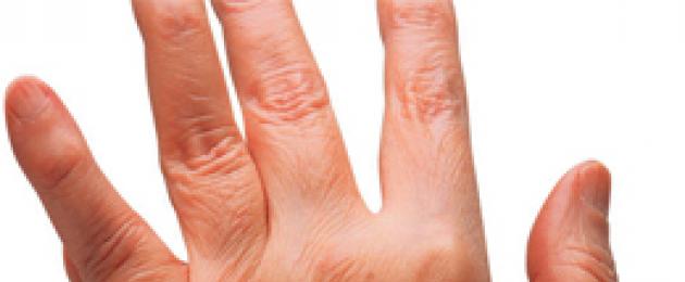 Почему немеет большой палец на правой руке? Лучшие советы. Что делать при онемении большого пальца на руке
